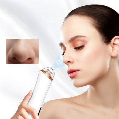 GlowEase | Microdermabrasion Kit – Blackhead Remover – USB Rechargeable – At-Home Skincare Solution
