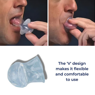 SnoreGuard Anti-Snoring Tongue Retainer | Comfortable - Reduce Snoring and Improve Sleep Quality