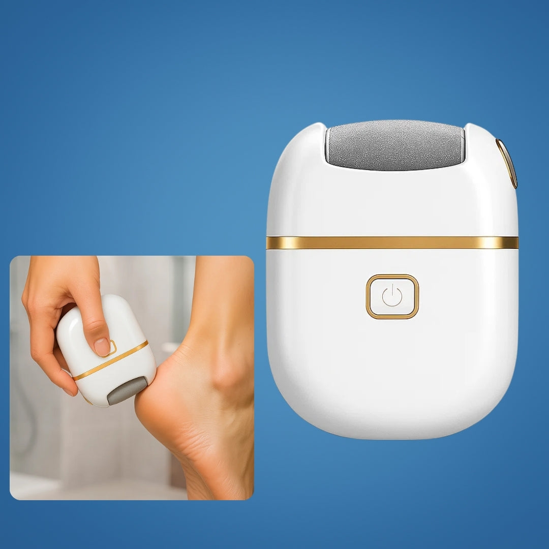 SoleSmooth | Electric Foot File – Callus Remover – Rechargeable Cordless – Heals Cracked Heels – Restores Soft, Smooth Feet at Home