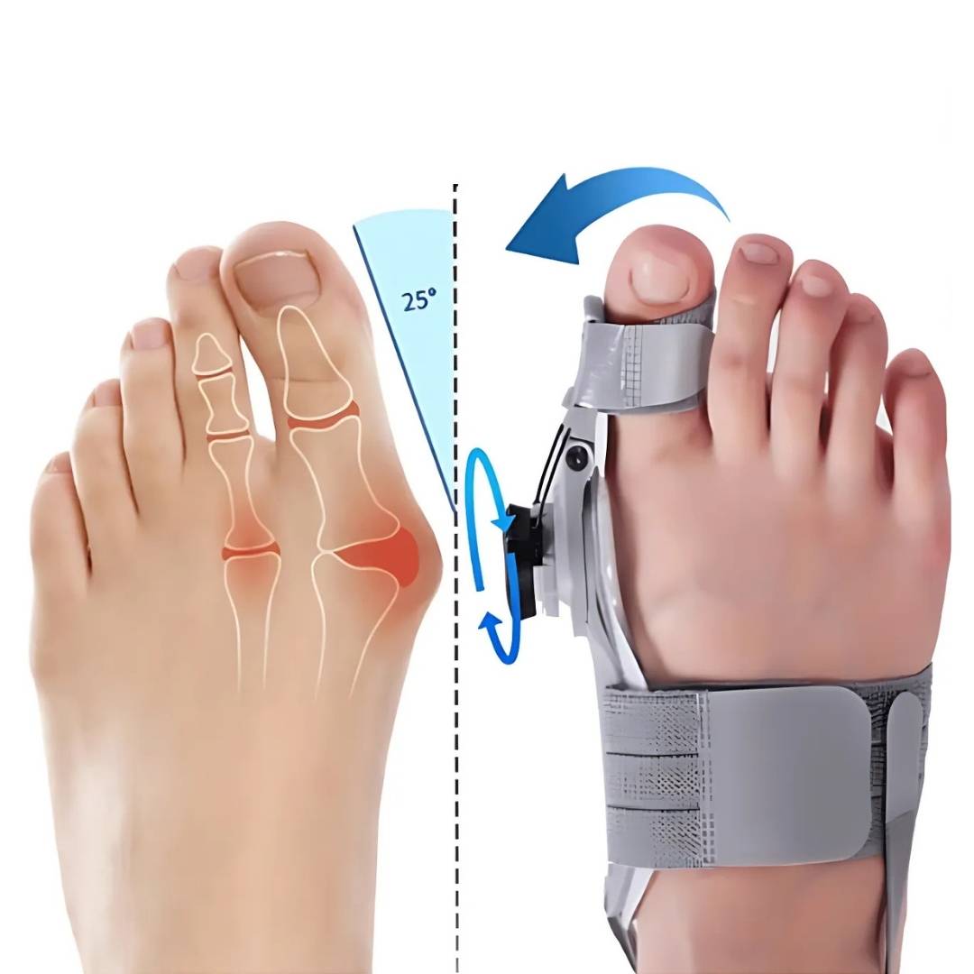 BunionEase Adjustable Relief Brace | for Hallux Valgus - Gently Correct and Alleviate Pain Associated with Bunions