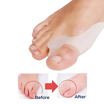 BunionGuard Hallux Valgus | Silicone Protection with Toe Spreader - Pain Relief and Corrective Alignment