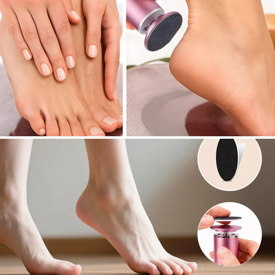 SmoothStep | Electric Foot File Callus Remover – Hard Skin Removal – Waterproof Rechargeable – Restores Soft Smooth Feet Instantly