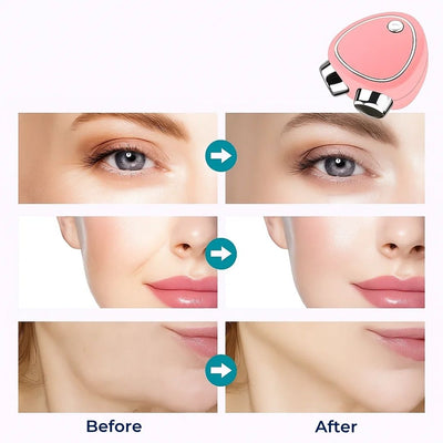 RejuvTone | EMS Facial Toner – Non‑surgical Lift – USB‑rechargeable Lightweight Device – Anti‑ageing Skincare