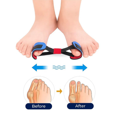ToeAligner Pro | Bunion Corrector Strap – Adjustable Day-Night Support – Breathable Hypoallergenic Fabric – Pain Relief for Adults