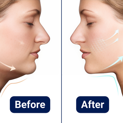 Facial Tightening Massager for Double Chin Reduction