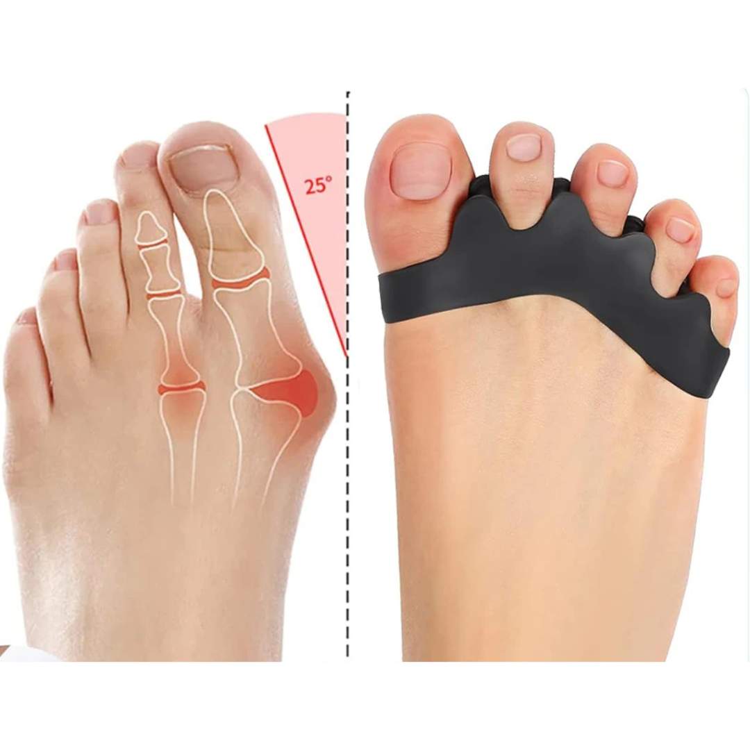 FlexAlign Toe Spacer | Toe Realignment and Pain Relief – Ideal for Bunions - Overlapping Toes - and Foot Comfort