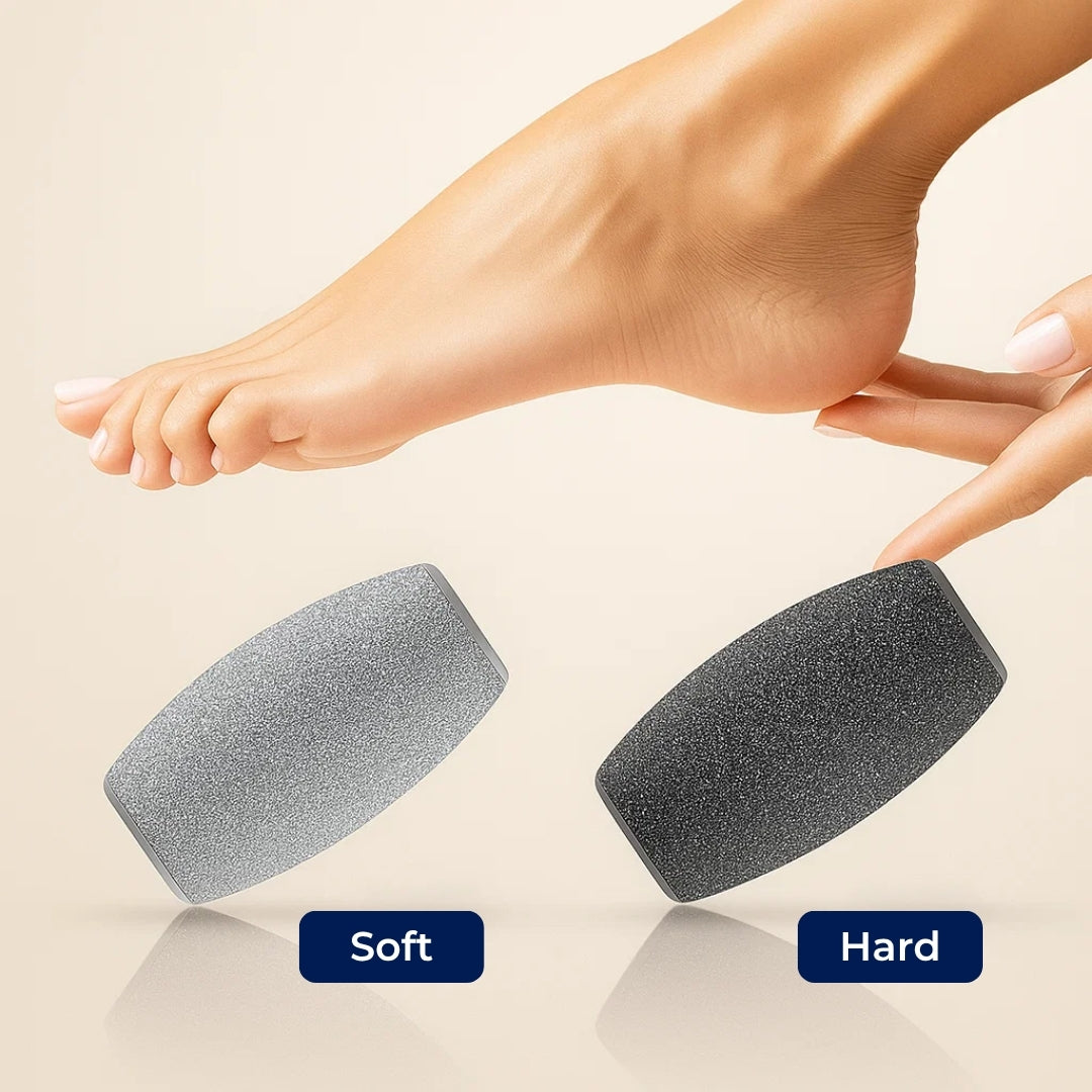 SoleSmooth | Electric Foot File – Callus Remover – Rechargeable Cordless – Heals Cracked Heels – Restores Soft, Smooth Feet at Home