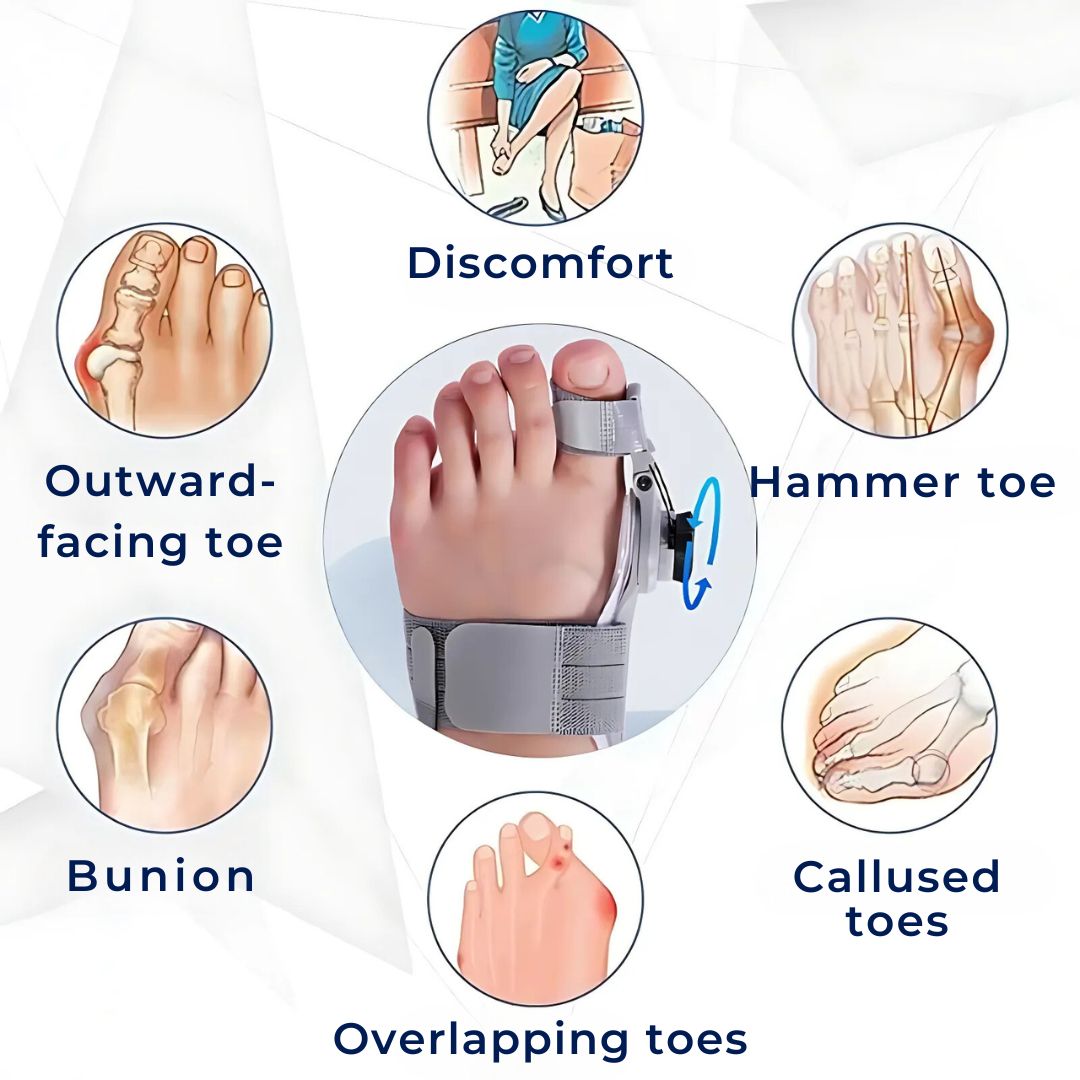 BunionEase Adjustable Relief Brace | for Hallux Valgus - Gently Correct and Alleviate Pain Associated with Bunions