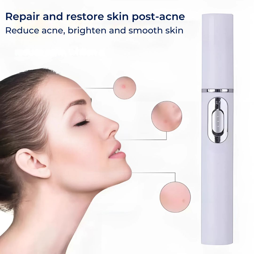 ClearGlow Blue Light Skin Therapy Pen | Acne Treatment - Anti-inflammatory - Non-invasive Solution - Clearer Skin - Blemish Reduction