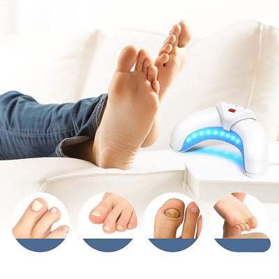 FungiFree | Laser Nail Fungus Device – Dual‑Wavelength Penetration – Compact Home Use – Fungal Nail Restoration