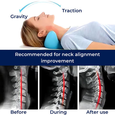 NeckAlign Chiropractic Neck Pillow | Stretcher for Neck - Pain Relief - Improved Posture - Better Sleep