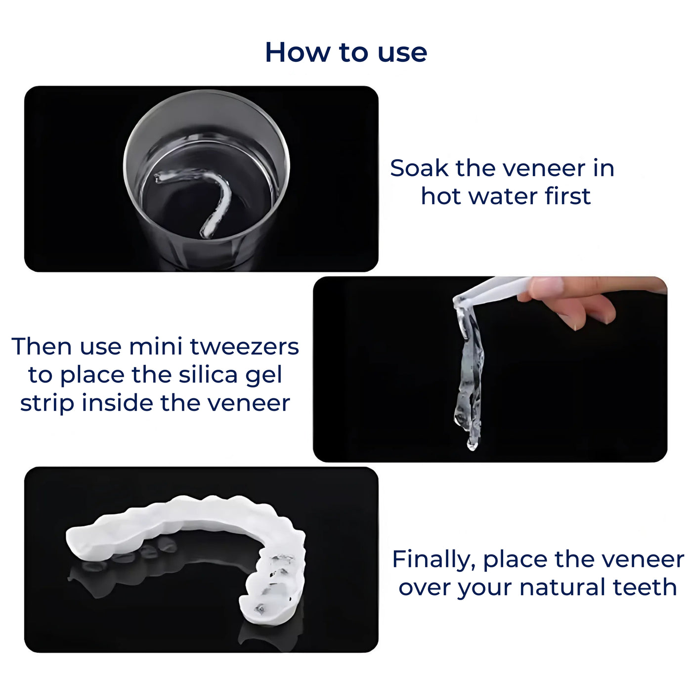 SmileEase | Clip-On Veneers – Instant Smile Enhancement – Ultra-Thin Design – Ideal for Adults Seeking Affordable Dental Solutions