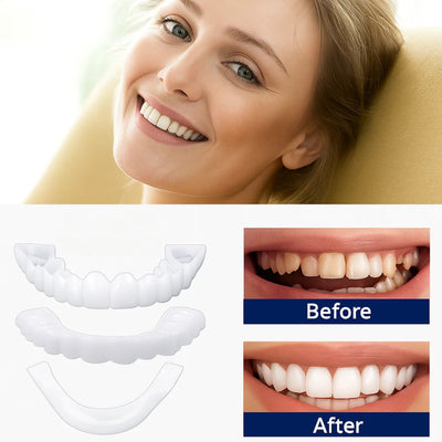 SmileEase | Clip-On Veneers – Instant Smile Enhancement – Ultra-Thin Design – Ideal for Adults Seeking Affordable Dental Solutions