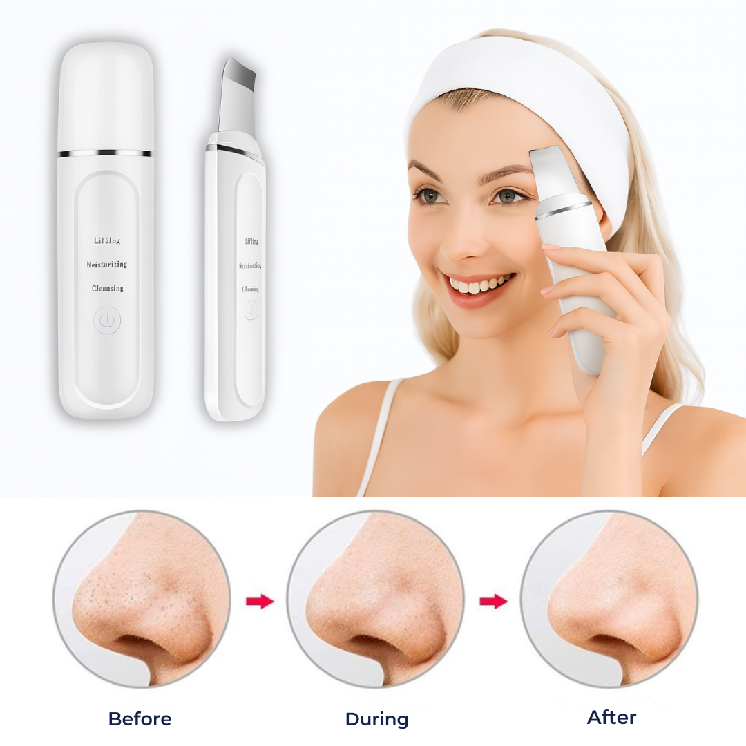 GlowSonic | Ultrasonic Facial Wand – Deep Cleansing – 33,000 Vibrations – At-Home Skincare Tool