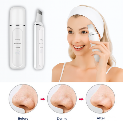 GlowSonic | Ultrasonic Facial Wand – Deep Cleansing – 33,000 Vibrations – At-Home Skincare Tool